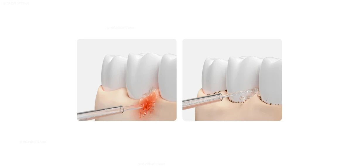 Xiaomi Mijia Portable Oral Irrigator,4 Mode 200ML Rechargeable Flossers IPX7 Waterproof Portable Cordless Teeth Cleaning Machine